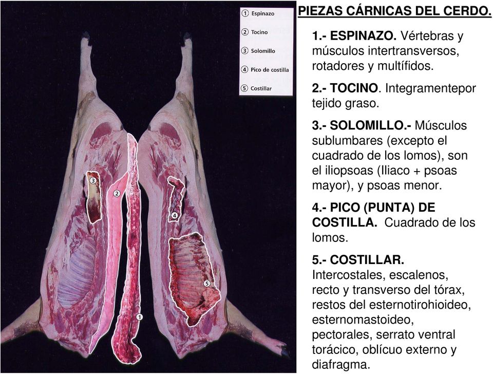 ventral torácico, oblícuo externo y diafragma. 1.- ESPINAZO. Vértebras y músculos intertransversos, rotadores y multífidos. 2.