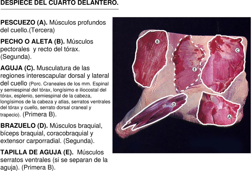 Espinal y semiespinal del tórax, longísimo e iliocostal del tórax, esplenio, semiespinal de la cabeza, longísimos de la cabeza y atlas, serratos ventrales del tórax y
