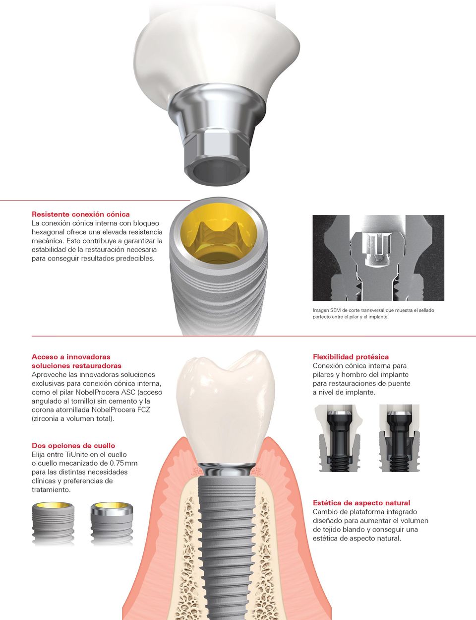 Imagen SEM de corte transversal que muestra el sellado perfecto entre el pilar y el implante.