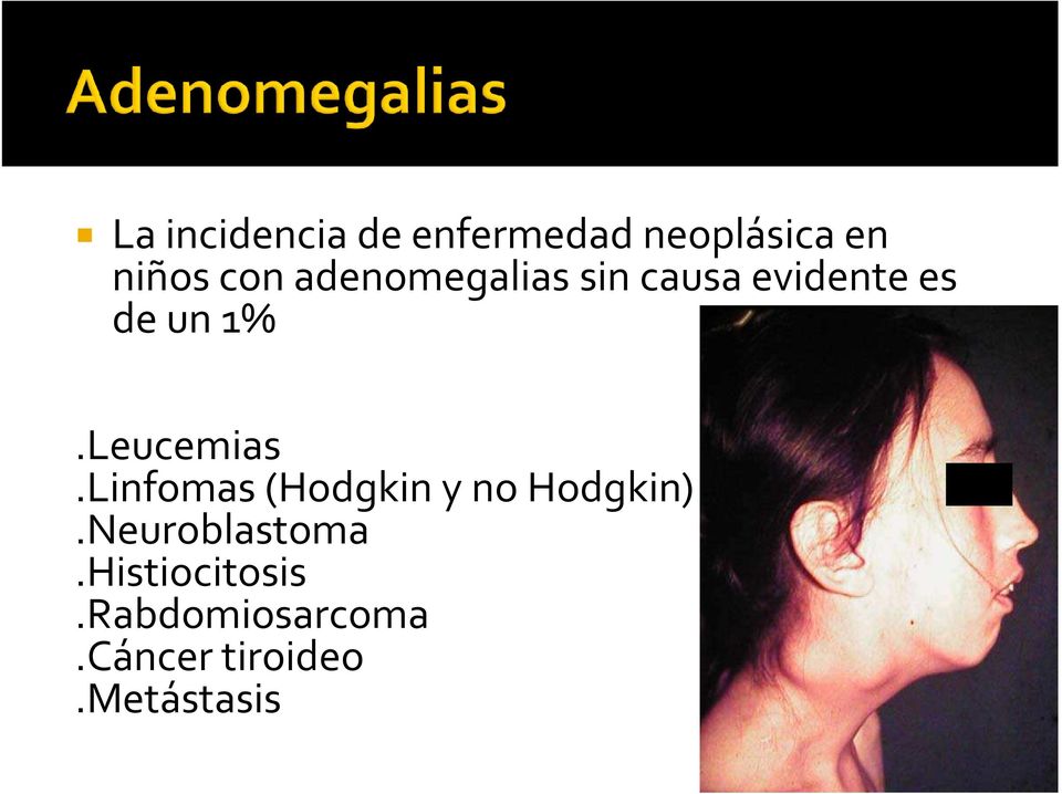 Leucemias.Linfomas (Hodgkin y no Hodgkin).