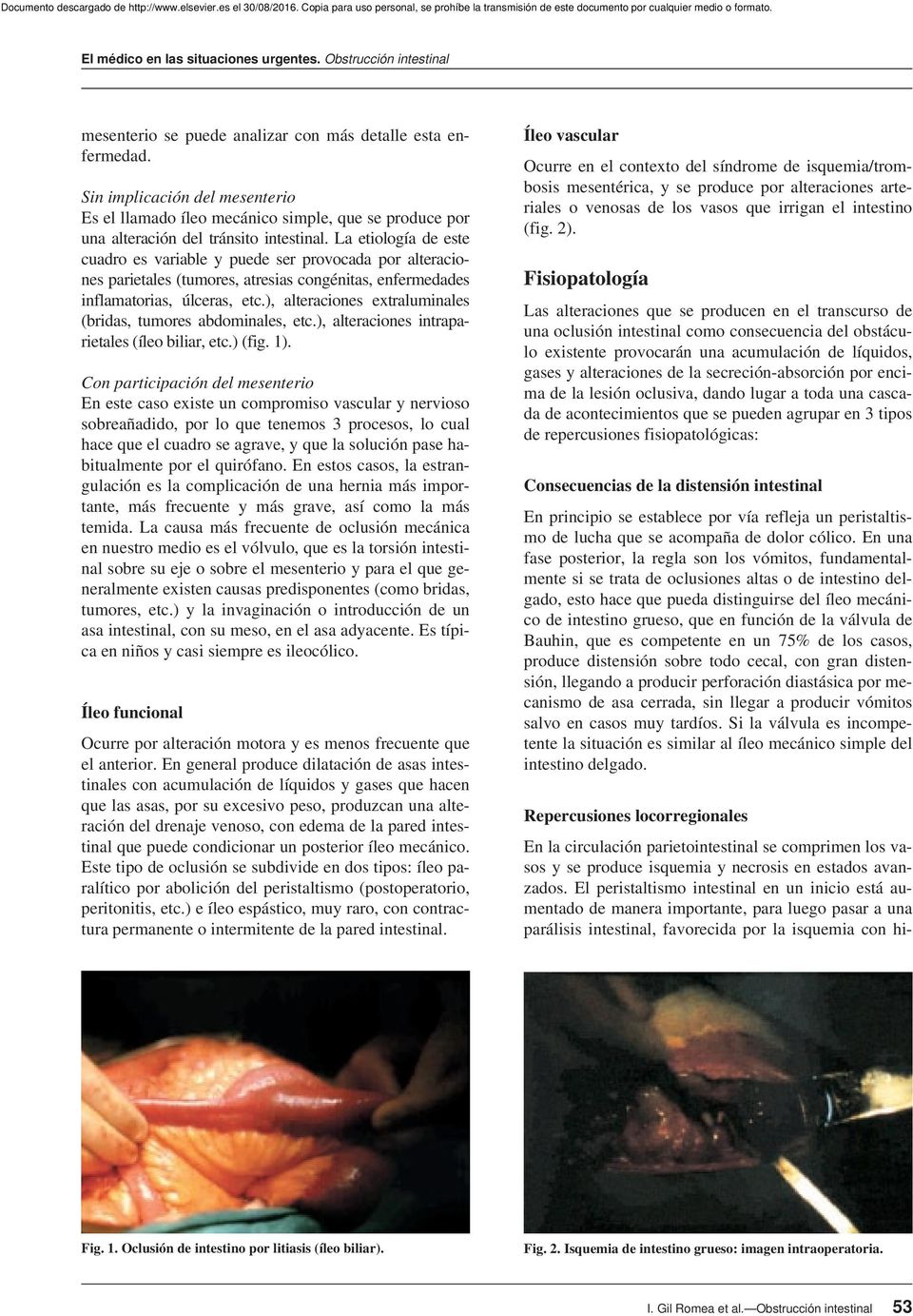 ), alteraciones extraluminales (bridas, tumores abdominales, etc.), alteraciones intraparietales (íleo biliar, etc.) (fig. 1).