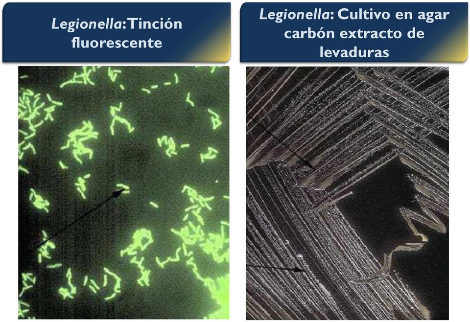 Legionella: Cultivo en