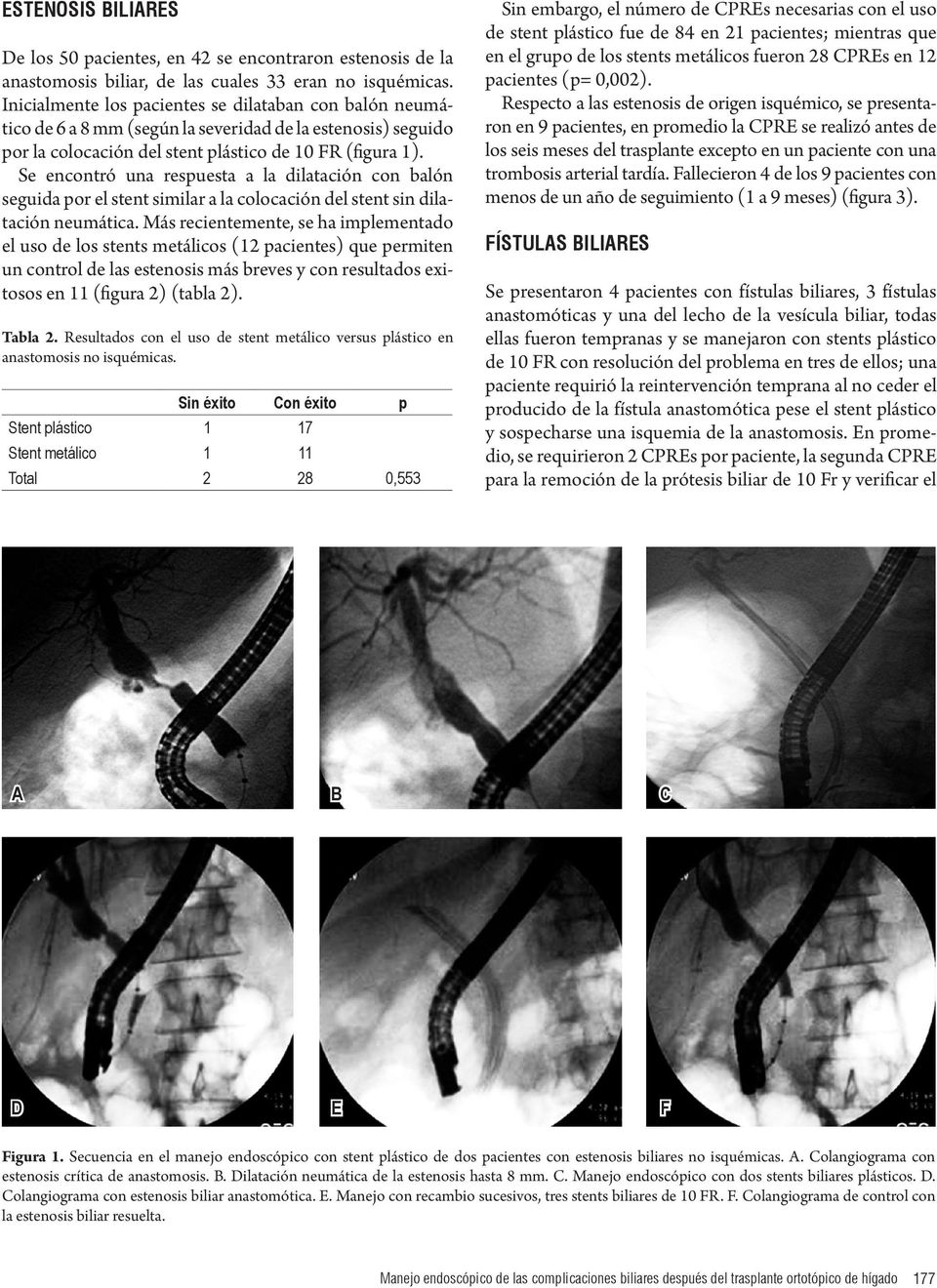 Se encontró una respuesta a la dilatación con balón seguida por el stent similar a la colocación del stent sin dilatación neumática.