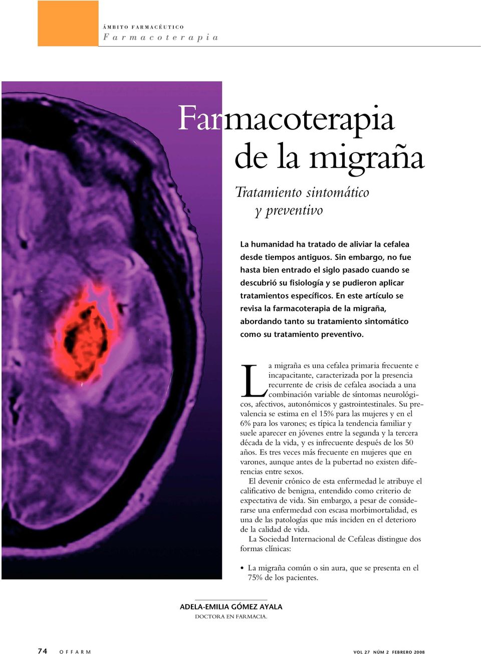 En este artículo se revisa la farmacoterapia de la migraña, abordando tanto su tratamiento sintomático como su tratamiento preventivo.