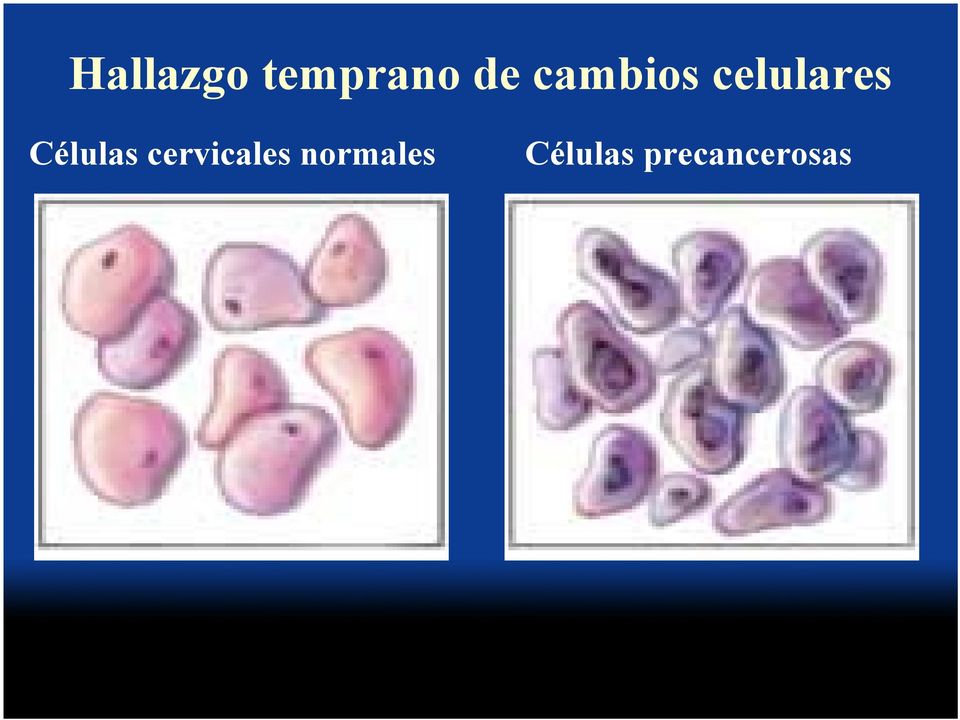 Células cervicales
