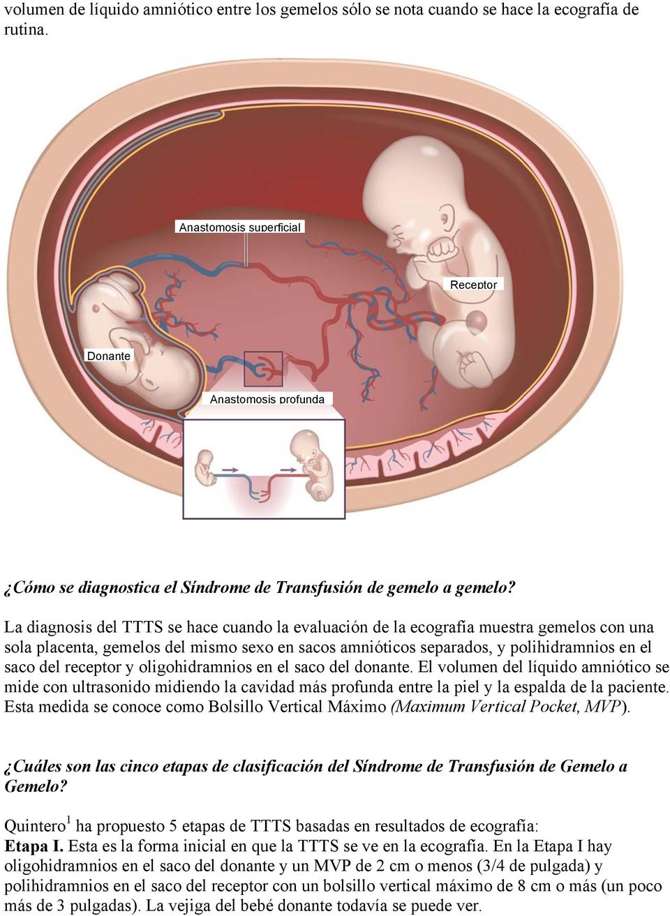 La diagnosis del TTTS se hace cuando la evaluación de la ecografía muestra gemelos con una sola placenta, gemelos del mismo sexo en sacos amnióticos separados, y polihidramnios en el saco del
