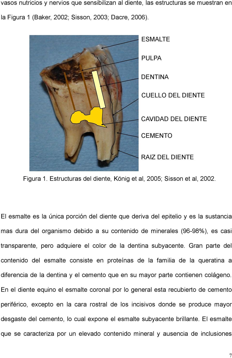 El esmalte es la única porción del diente que deriva del epitelio y es la sustancia mas dura del organismo debido a su contenido de minerales (96-98%), es casi transparente, pero adquiere el color de