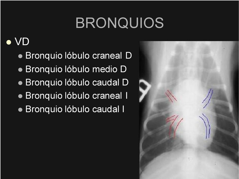 Bronquio lóbulo caudal D Bronquio
