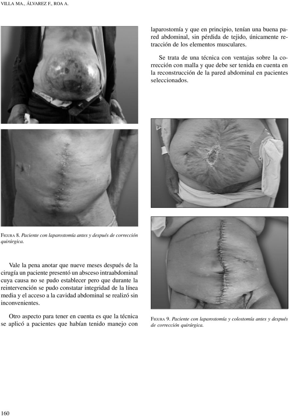 Paciente con laparostomía antes y después de corrección quirúrgica.