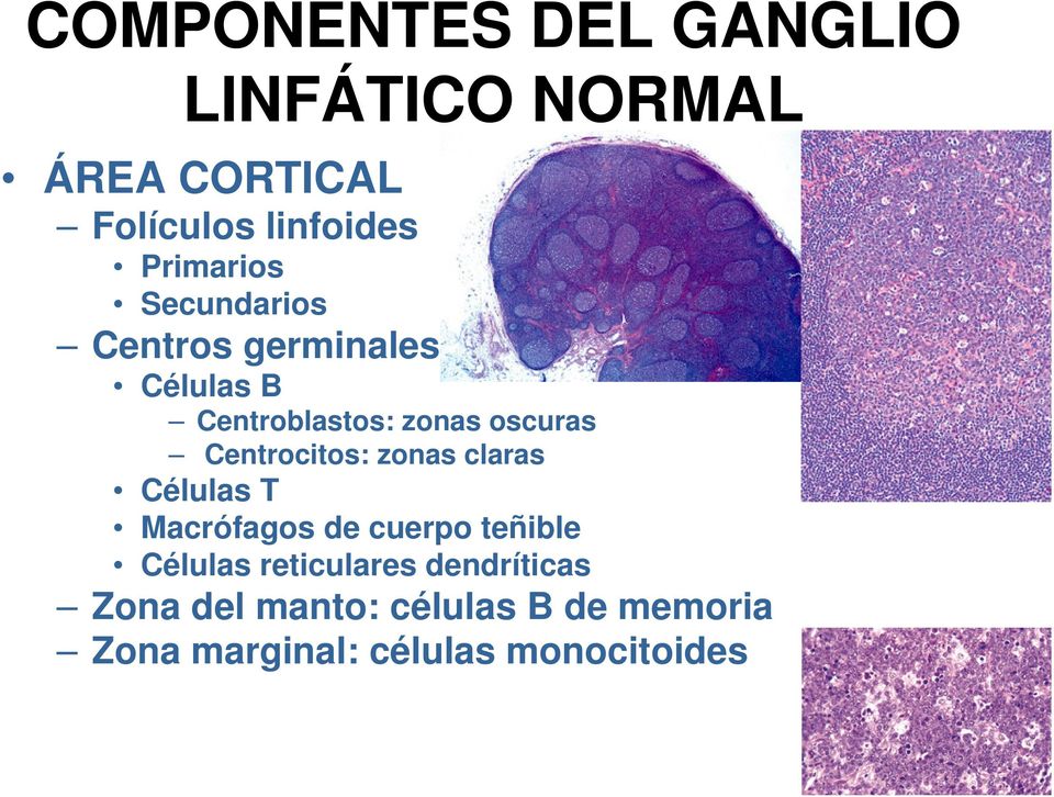 Centrocitos: zonas claras Células T Macrófagos de cuerpo teñible Células
