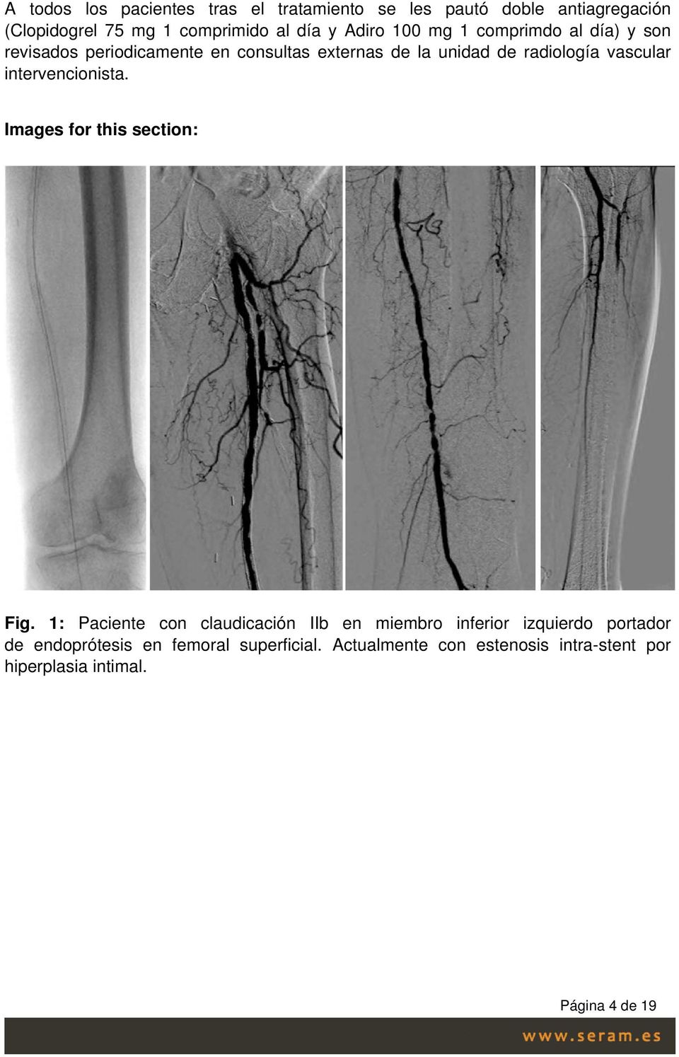 vascular intervencionista. Images for this section: Fig.