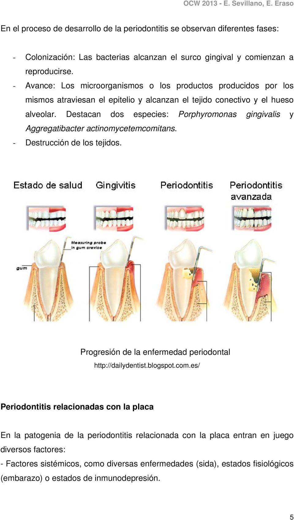 Destacan dos especies: Porphyromonas gingivalis y Aggregatibacter actinomycetemcomitans. - Destrucción de los tejidos. Progresión de la enfermedad periodontal http://dailydentist.blogspot.