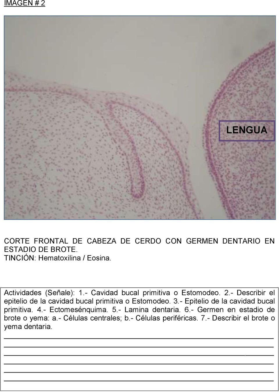 Histologia Bucodentaria Embriologia Dentaria Pdf Descargar Libre