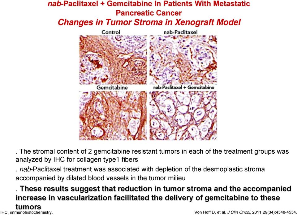 nab-paclitaxel treatment was associated with depletion of the desmoplastic stroma accompanied by dilated blood vessels in the tumor milieu.
