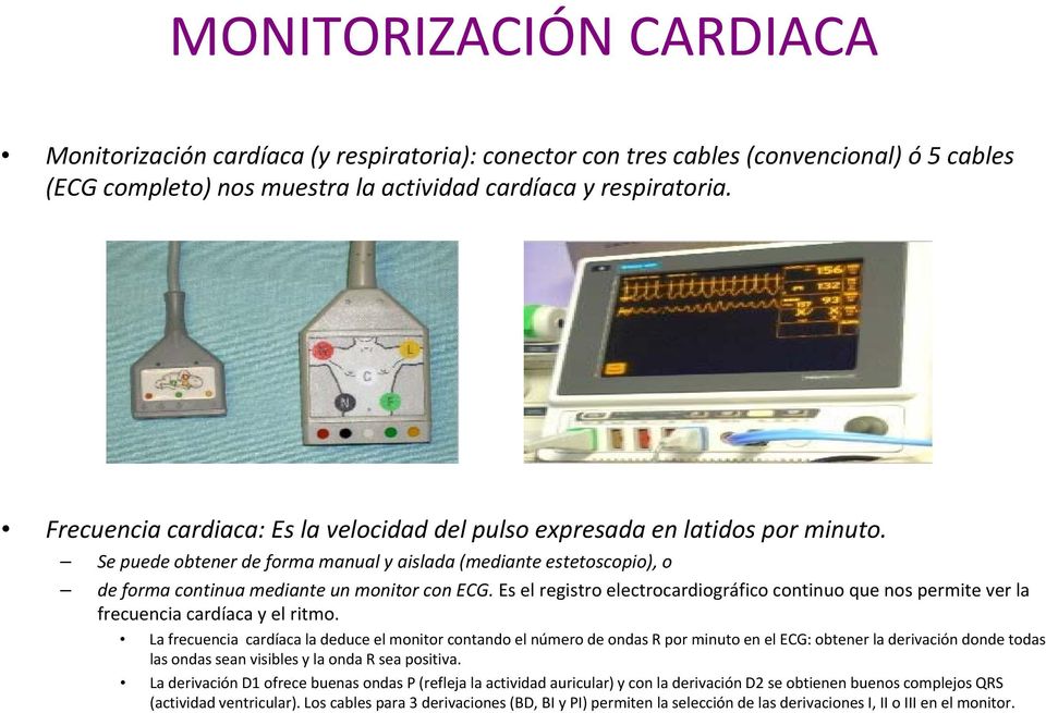 Es el registro electrocardiográfico continuo que nos permite ver la frecuencia cardíaca y el ritmo.