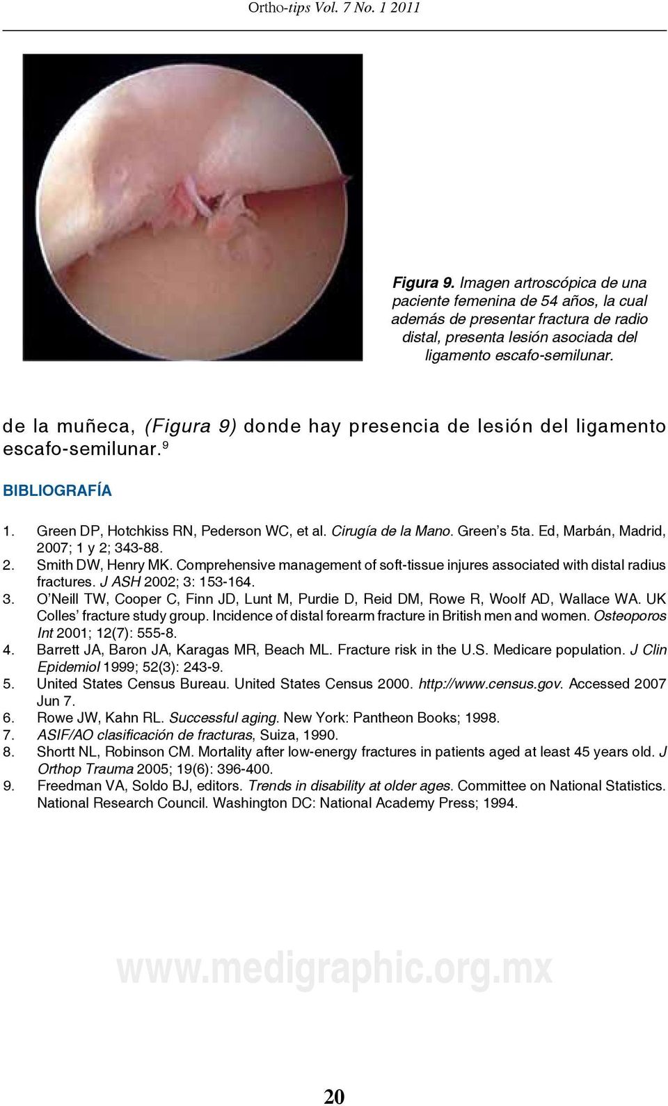 Ed, Marbán, Madrid, 007; y ; -88.. Smith DW, Henry MK. Comprehensive management of soft-tissue injures associated with distal radius fractures. J ASH 00; : 5-6.