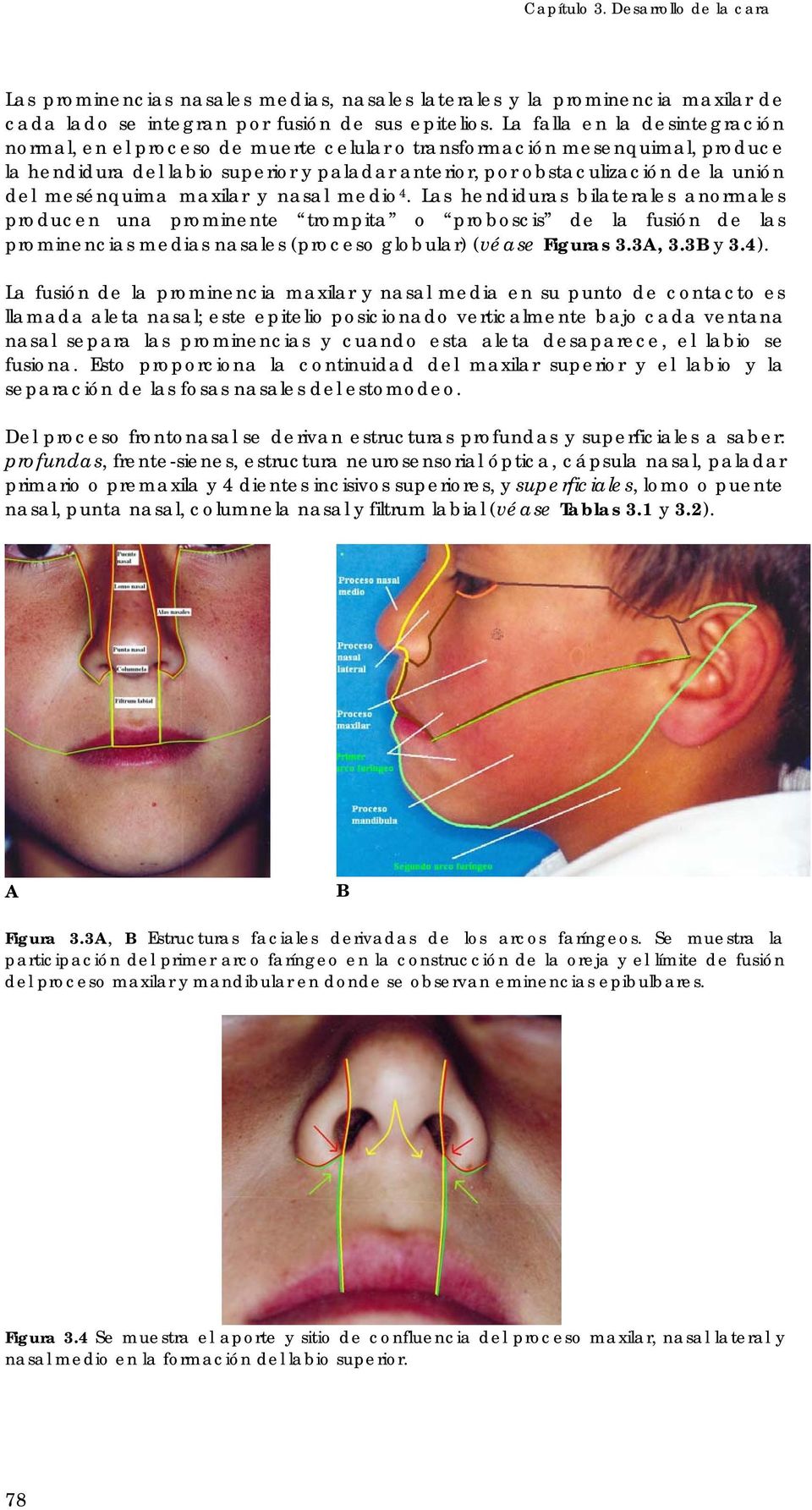 mesénquima maxilar y nasal medio 4.
