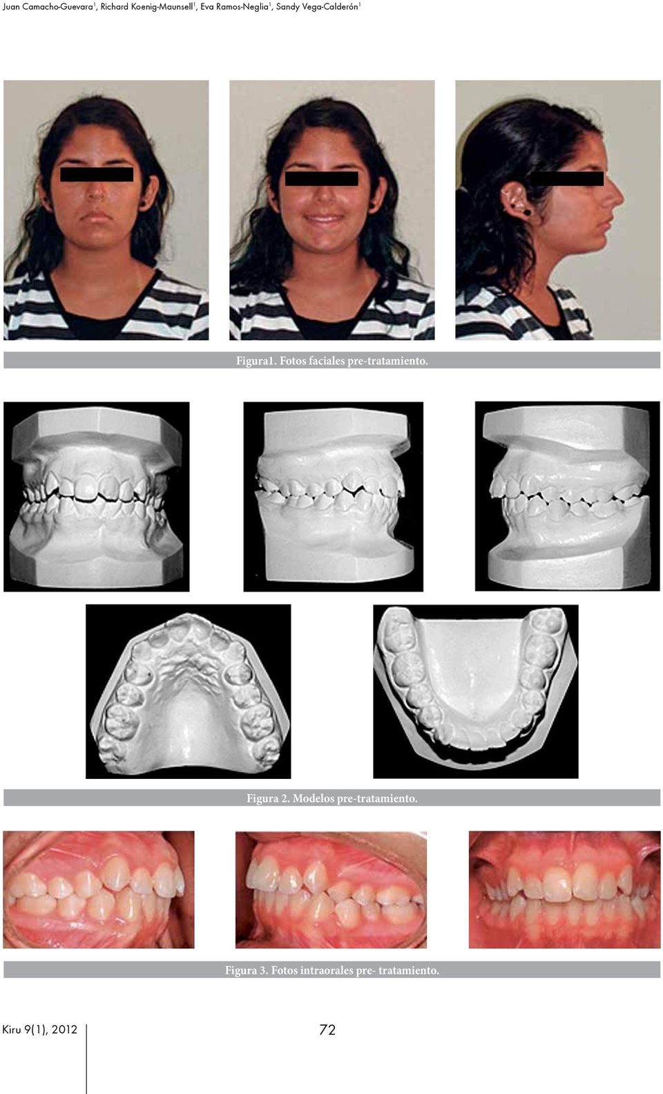 Fotos faciales pre-tratamiento. Figura 2.