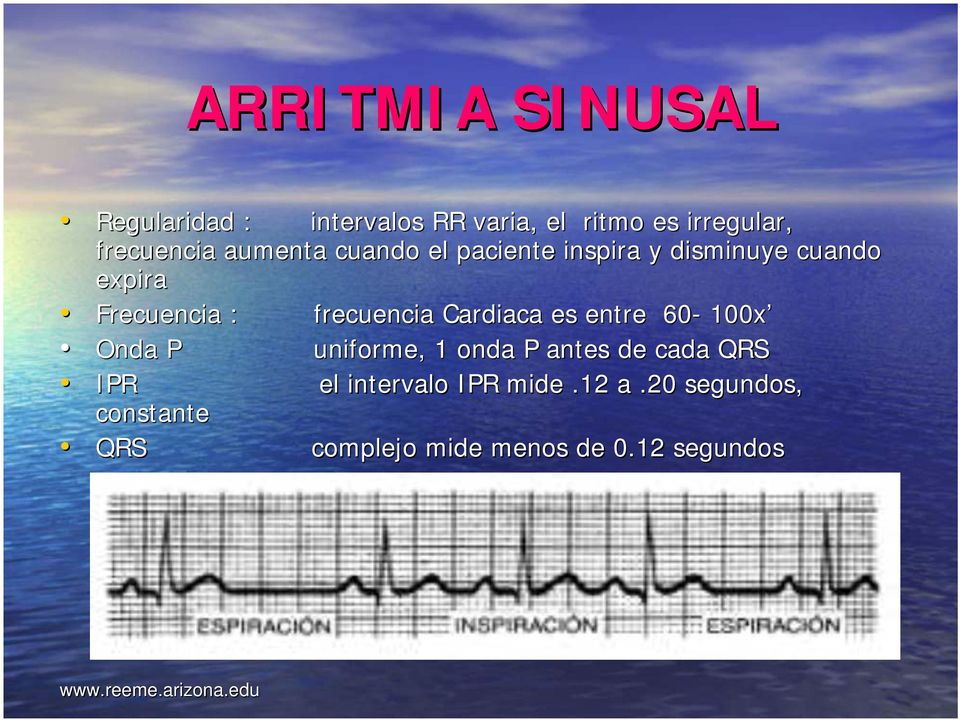 frecuencia Cardiaca es entre 60-100x Onda P uniforme, 1 onda P antes de cada QRS IPR