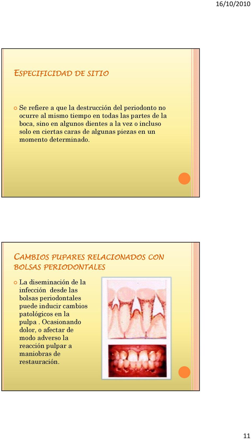 CAMBIOS PUPARES RELACIONADOS CON BOLSAS PERIODONTALES La diseminación de la infección desde las bolsas periodontales puede