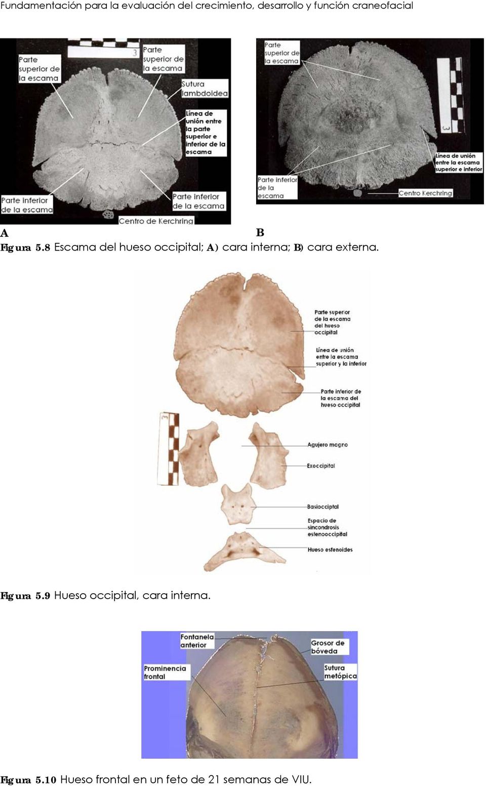 8 Escama del hueso occipital; A) cara interna; B) cara externa.