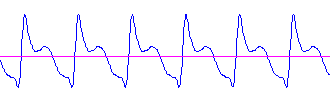 Amplitud Análisis de ondas no-sinusoidales comunes Señales periódicas no sinusoidales La amplitud disminuye exponencialmente en los harmónicos