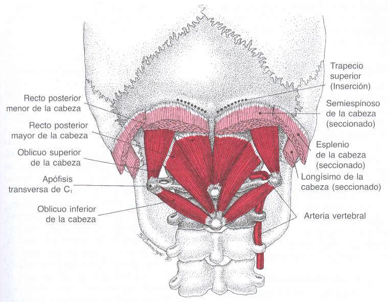 Consideraciones Anatómicas- Músculos vertebrales Cervicales Músculos de la Nuca - Suboccipitales 3 1 4 2 1.-Recto Posterior Mayor Extensor Rotador ipsilateral Inclinador ipsilateral 2.