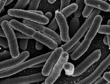 8 Figura 6: Morfología de bacterias: se muestran los tipos de bacterias (arriba) y fotomicrografías electrónicas de las células bacterianas de cada tipo (abajo).