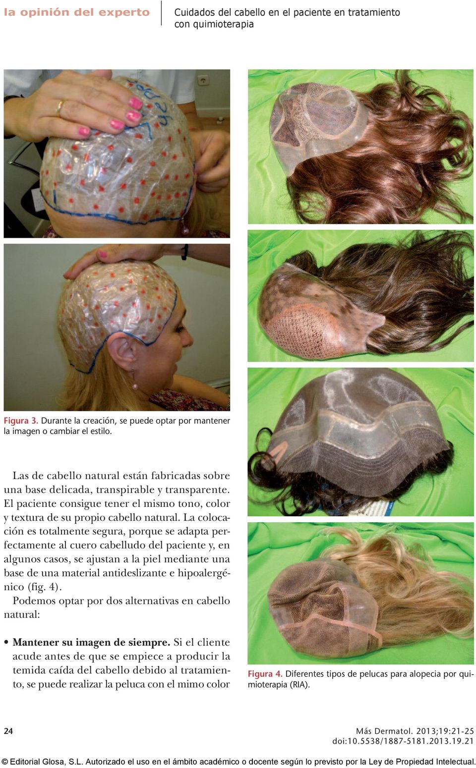 La colocación es totalmente segura, porque se adapta perfectamente al cuero cabelludo del paciente y, en algunos casos, se ajustan a la piel mediante una base de una material antideslizante e