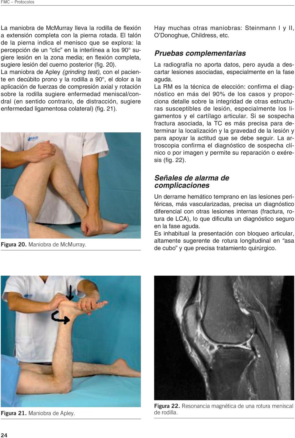 La maniobra de Apley (grinding test), con el paciente en decúbito prono y la rodilla a 90, el dolor a la aplicación de fuerzas de compresión axial y rotación sobre la rodilla sugiere enfermedad