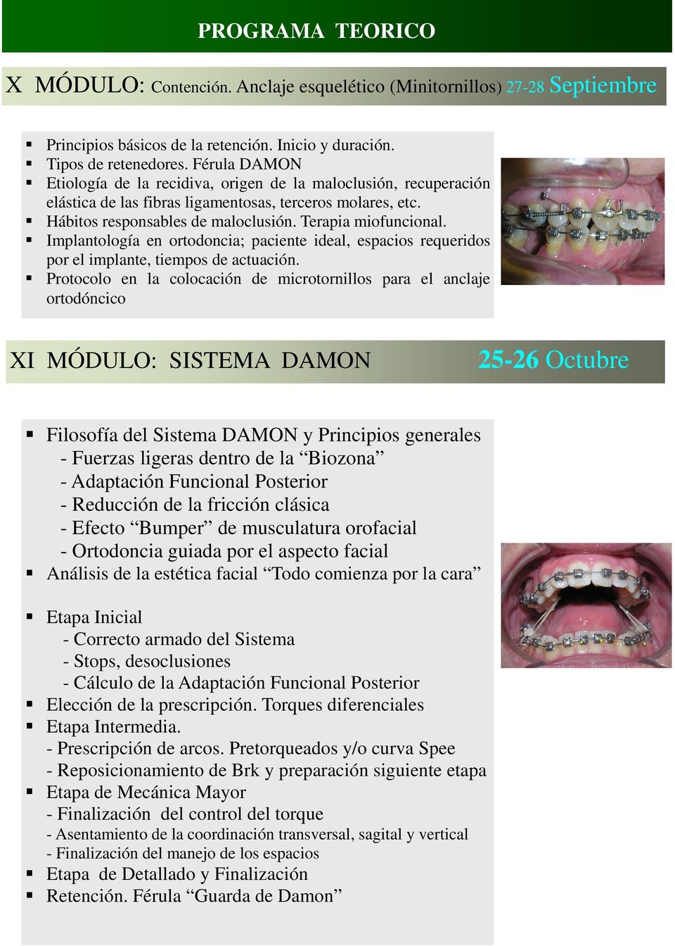 Implantología en ortodoncia; paciente ideal, espacios requeridos por el implante, tiempos de actuación.
