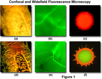La distinción fundamental entre la microscopía óptica convencional y la