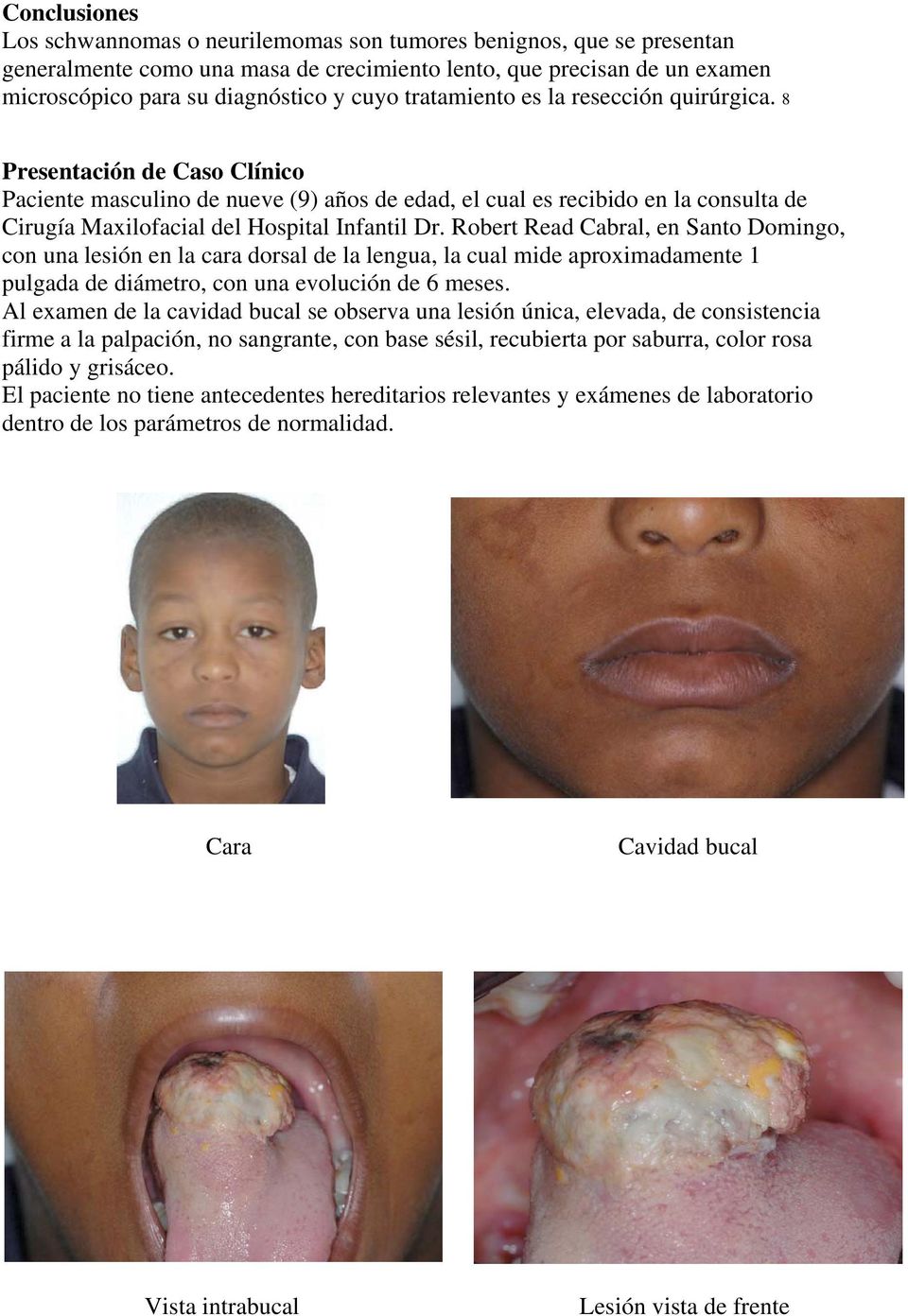 8 Presentación de Caso Clínico Paciente masculino de nueve (9) años de edad, el cual es recibido en la consulta de Cirugía Maxilofacial del Hospital Infantil Dr.
