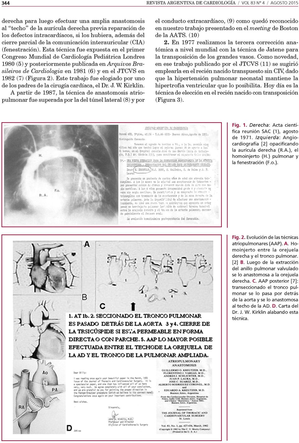 Esta técnica fue expuesta en el primer Congreso Mundial de Cardiología Pediátrica Londres 1980 (5) y posteriormente publicada en Arquivos Brasileiros de Cardiologia en 1981 (6) y en el JTCVS en 1982