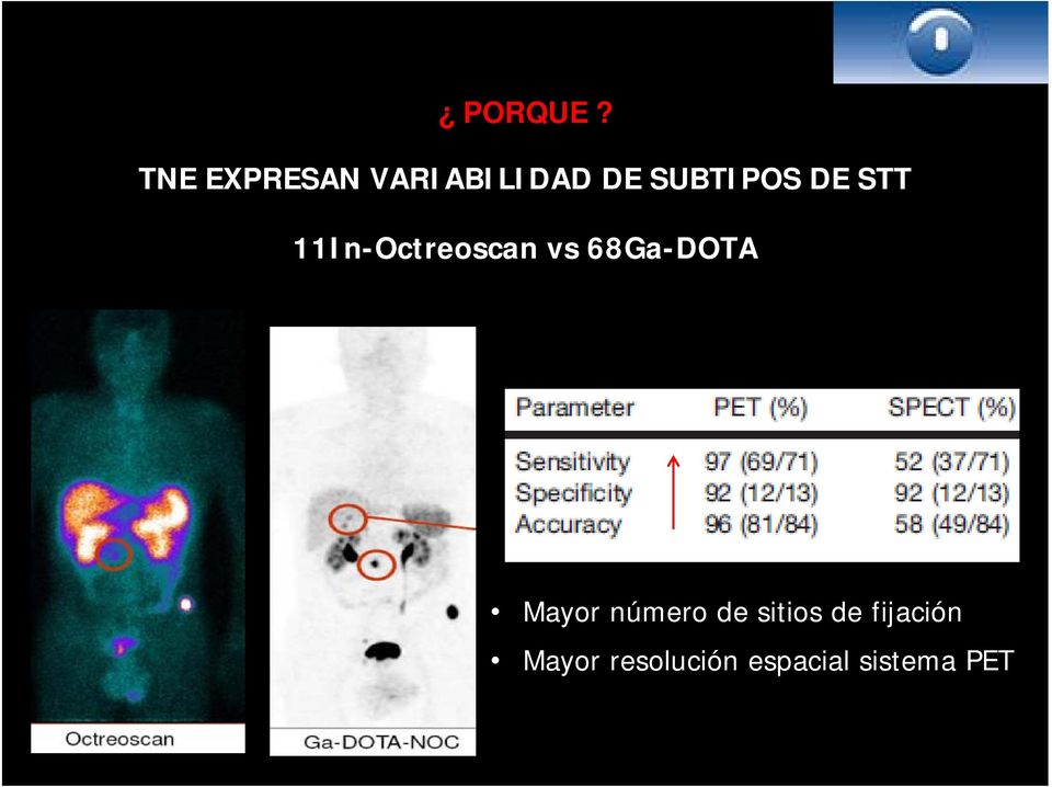DE STT 11In-Octreoscan vs 68Ga-DOTA
