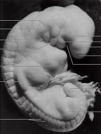 Figura 1. Embrión de 4 semanas, estadio 13. Adaptado de Embriología Clínica. (Moore, 2008). Figura 2.