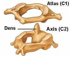 ATLAS Y AXIS Son las dos primeras vértebras cervicales El atlas sujeta la cabeza y articula la cabeza con la columna El atlas tiene dos masas laterales y dos arcos: uno anterior y otro