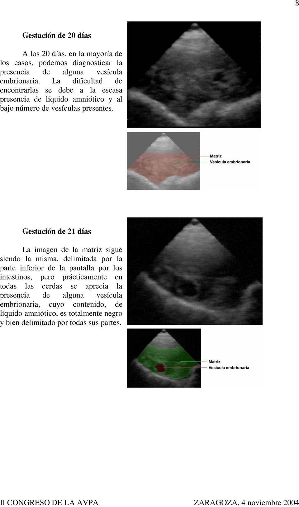 Gestación de 21 días La imagen de la matriz sigue siendo la misma, delimitada por la parte inferior de la pantalla por los intestinos, pero