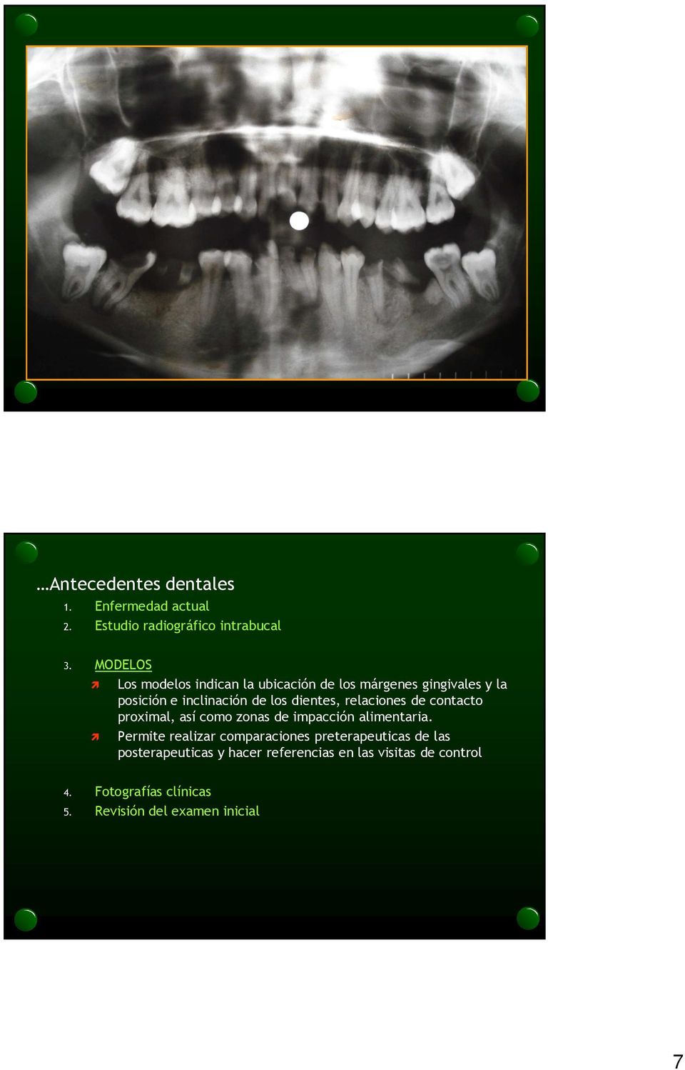 dientes, relaciones de contacto proximal, así como zonas de impacción alimentaria.