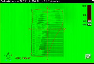 146 Anexo XI Comparación Portal Dosimetry versus PV IMRTQA En este anexo se