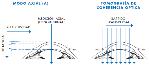 2. FUNDAMENTOS DE LA TESINA. 2.1. Tomografía de coherencia óptica (OCT).