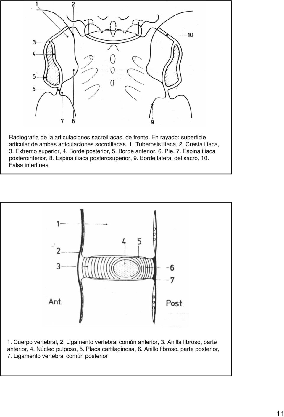 Espina ilíaca posterosuperior, 9. Borde lateral del sacro, 10. Falsa interlínea 1. Cuerpo vertebral, 2. Ligamento vertebral común anterior, 3.