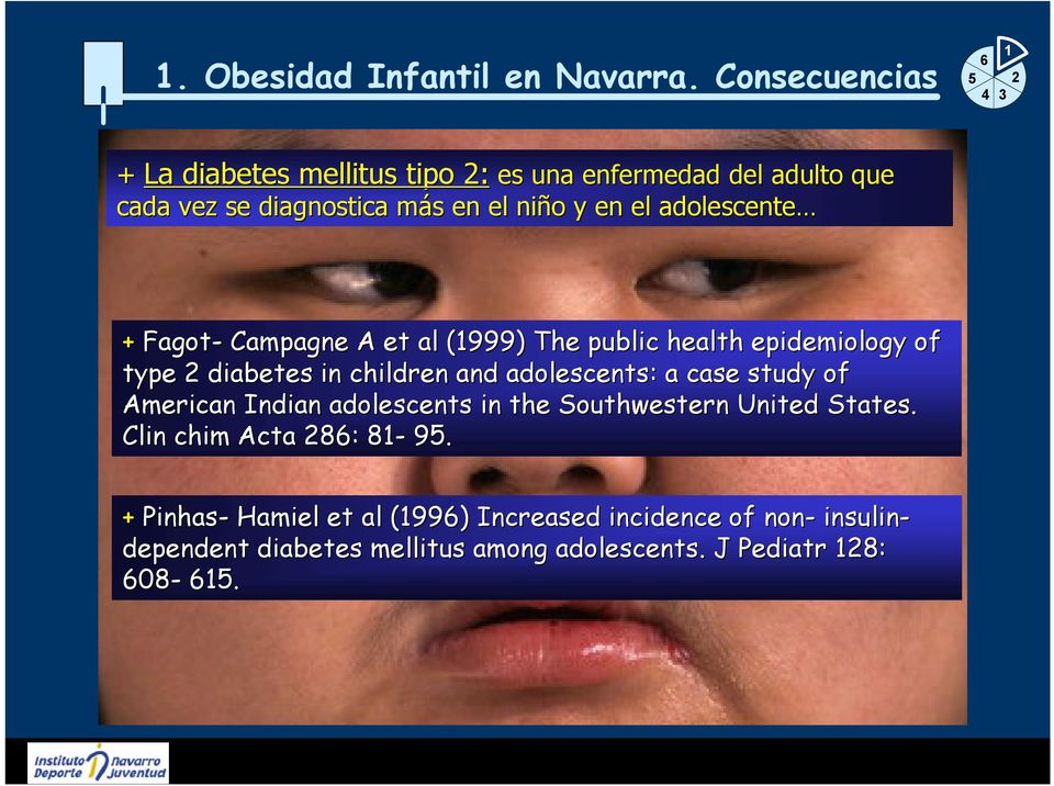 adolescente + Fagot- Campagne A et al l (1999) The public health epidemiology of type 2 diabetes in children and adolescents: : a case