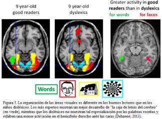 Neuropsicología de los trastornos de lectura Lectura Actividad funcional, intencional y compleja que implica la interacción de procesos perceptivos, cognitivos y lingüísticos que, a su vez,