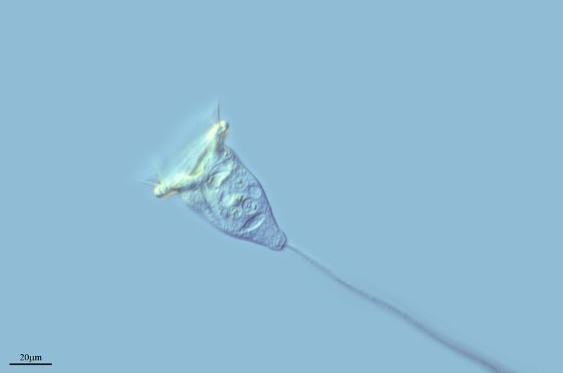 Ejemplos de protozoos Vorticela es un protozoo con cuerpo en forma de campana, que se une al sustrato mediante un pedúnculo contráctil, por lo que son sésiles.