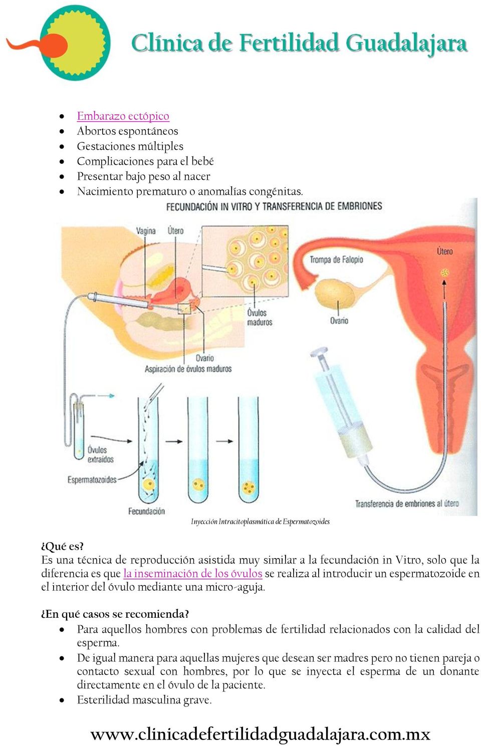 Es una técnica de reproducción asistida muy similar a la fecundación in Vitro, solo que la diferencia es que la inseminación de los óvulos se realiza al introducir un espermatozoide en el interior