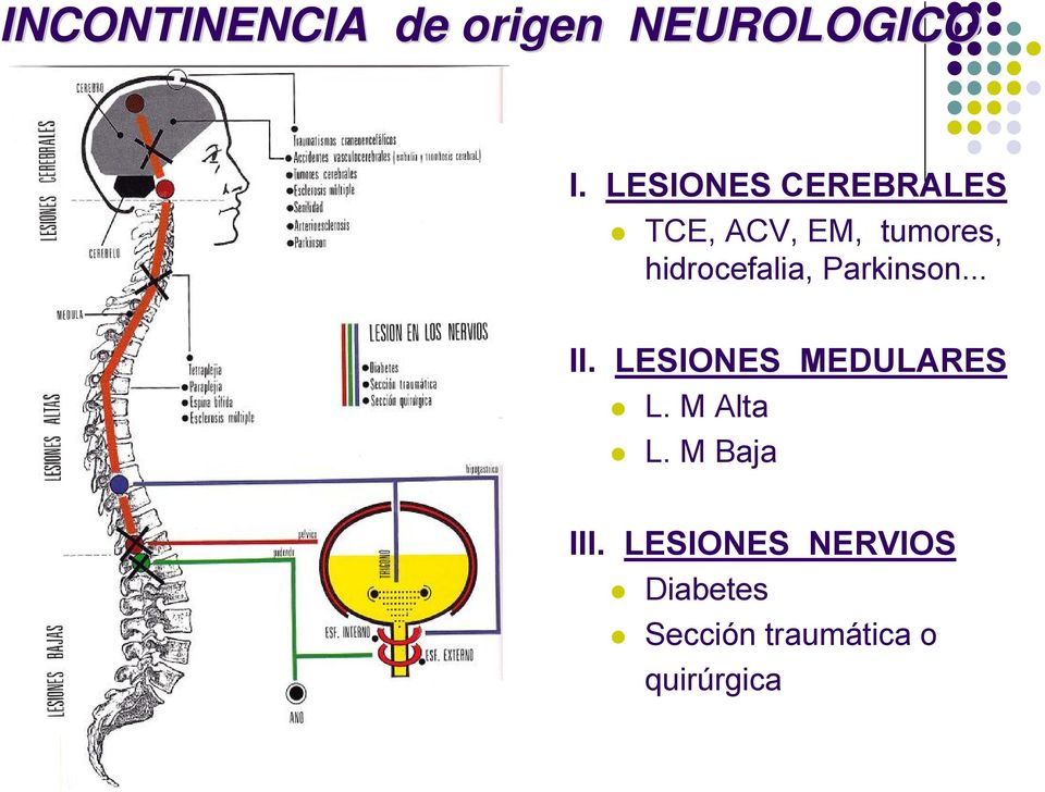hidrocefalia, Parkinson... II. LESIONES MEDULARES L.