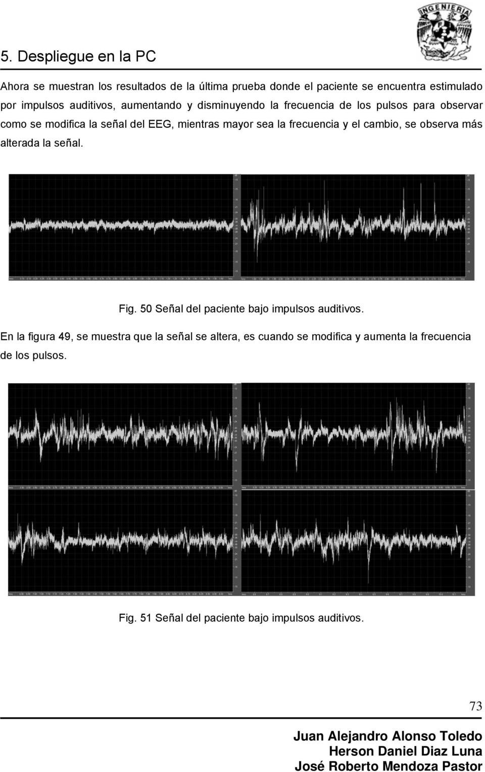 cambio, se observa más alterada la señal. Fig. 50 Señal del paciente bajo impulsos auditivos.