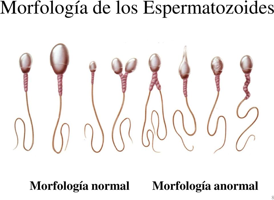 Morfología normal