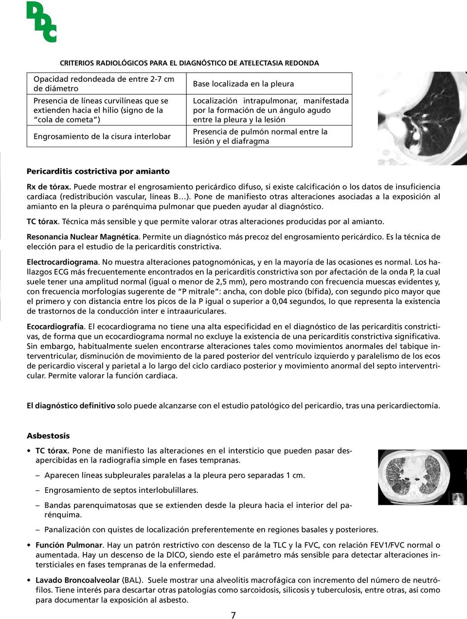 normal entre la lesión y el diafragma Pericarditis costrictiva por amianto Rx de tórax.